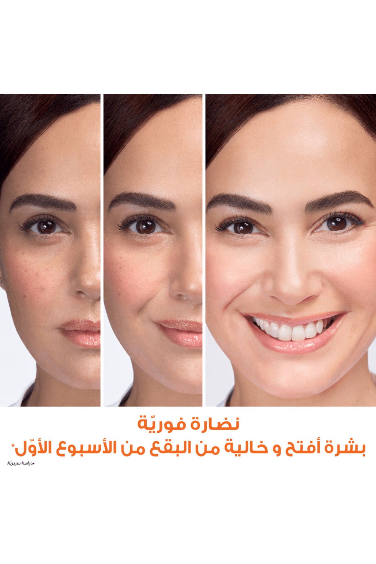 Garnier Fast Bright Vitamin C Radiance Cream 50ml